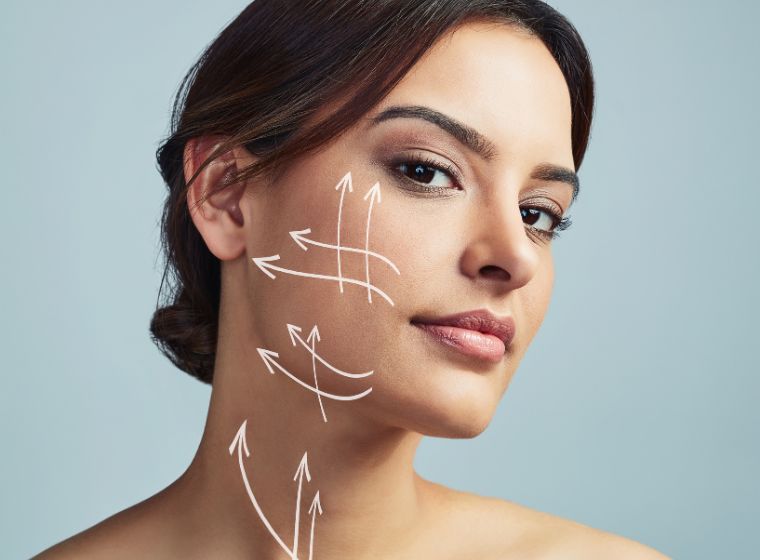 Lifting cervicofacial